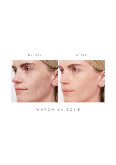 Fenty Skin Watch Ya Tone Leke Karşıtı Serum 30 ML