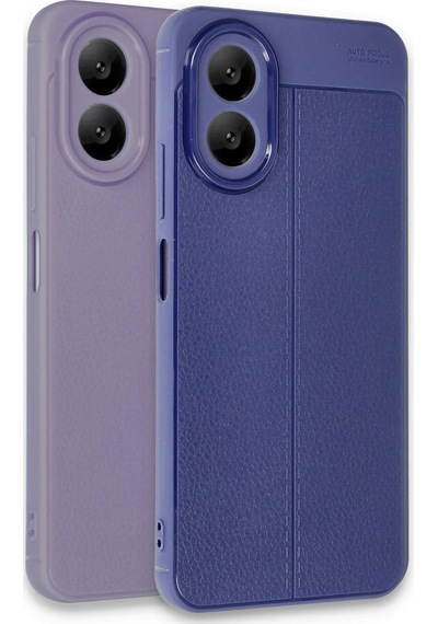 Cosmotex Newface Oppo A38 Kılıf Auto Focus Kapak - Lila