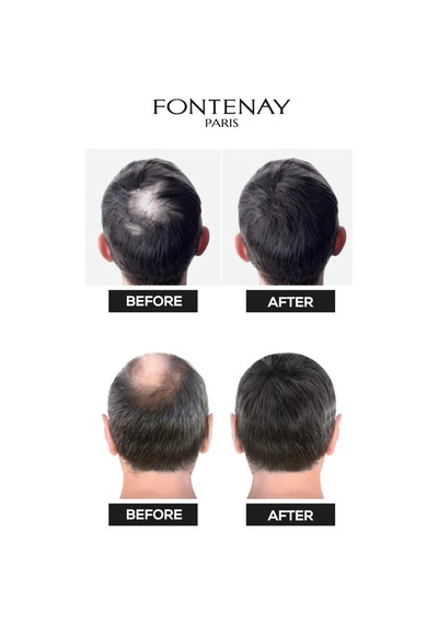 Fontenay Topik Keratin Fıbers Siyah