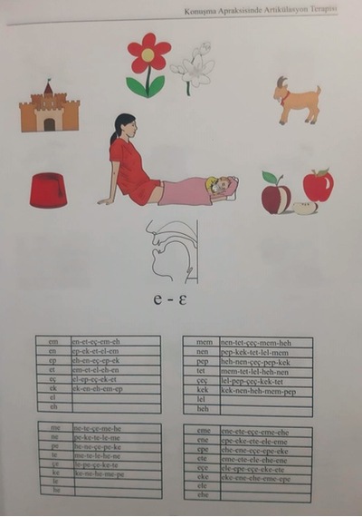 Konuşma Apraksisinde Artikülasyon  Terapisi