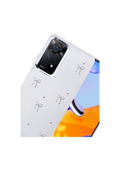 Newface - 256 - Xiaomi Redmi Note 11 Pro Fiyonk Desenli Kapak - - Spt-gld - Desen 5 Diğer