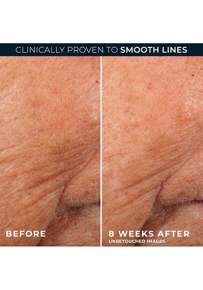Retinol Correxion Line Smoothing Kırışıklık Karşıtı Kapsül Serum 10 Adet