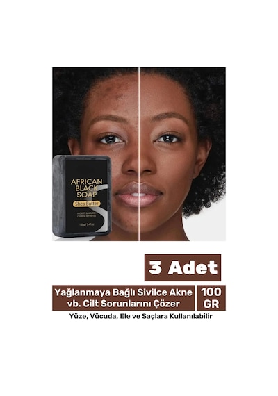 100% Doğal Güzel Kokulu El Yüz Saç Vücut Cilt Onaran Kolajen Etkili Afrika Bitkisel Sabun 3 Adet
