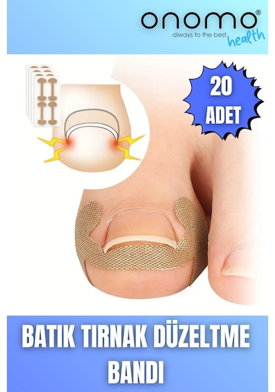 Onomo Health Batık Tırnak Düzeltme Bandı 20 Adet