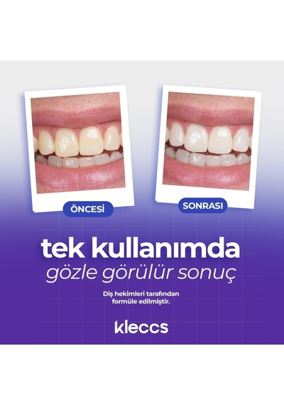 Diş Beyazlatma Bandı, Hızlı Beyazlık, 14 Paket-28 Bant, Hızlı Diş Beyazlatma Bandı, Günlük Ve Bireysel Kullanıma Uygun