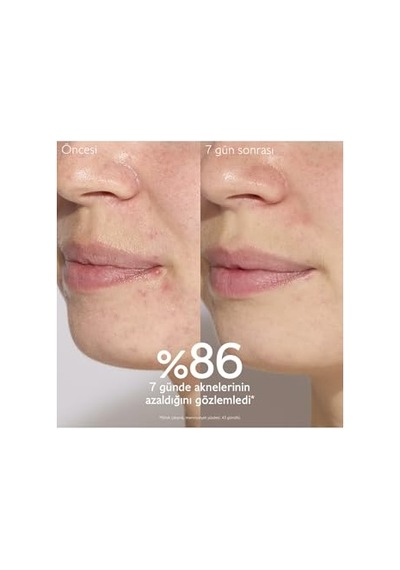 Tr Vinopure Serum Salisilik Asitli Kirlere Karşı