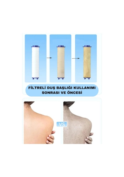 5 Fonksiyonlu Krom Beyaz Çelik Filtreli Kireç Önleyici Yüksek Basınçlı Tasarruflu Banyo Duş Başlığı