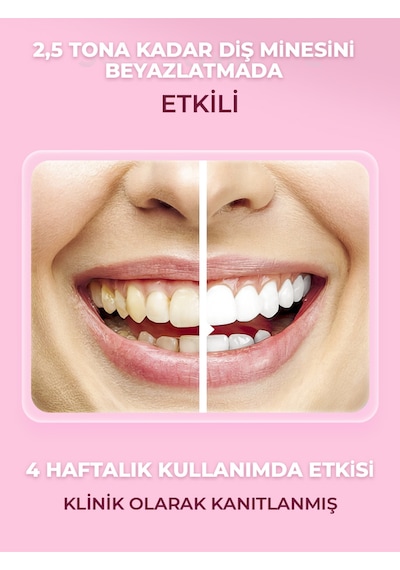 Splat Special Extreme White Beyazlatıcı Diş Macunu 75 Ml Beyazlık