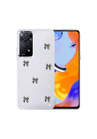 Redmi Note 11 Pro Fiyonk Desenli Kapak - Desen 8 Bzsxx00 1