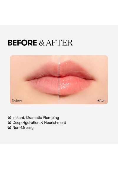 Reedle Shot Lıp Plumper