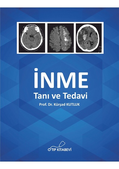 İnme Tanı Ve Tedavi