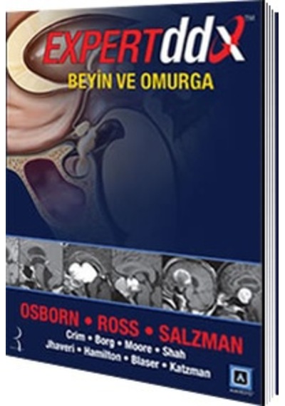 Expert Ddx: Beyin Ve Omurga/Anne G. Osborn.Jeff Ross.Karen L.