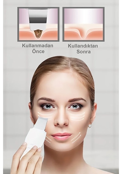 Markafox Ultrasonik Spatula Siyah Nokta Temizleme Aleti + Soğuk Buhar Makinesi