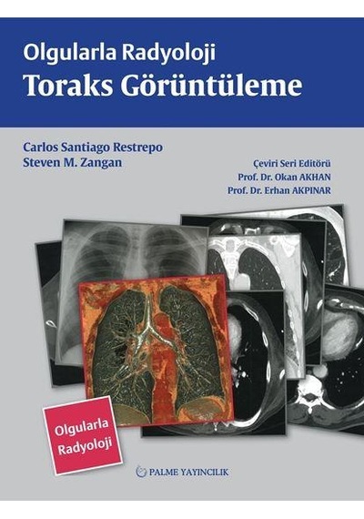 Olgularla Radyoloji Toraks Görüntüleme (Palme)