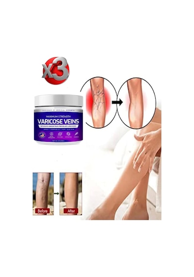 Süper Maximum Strength Varicose Veins Bakım Kremi 100 Ml X 3 Adet