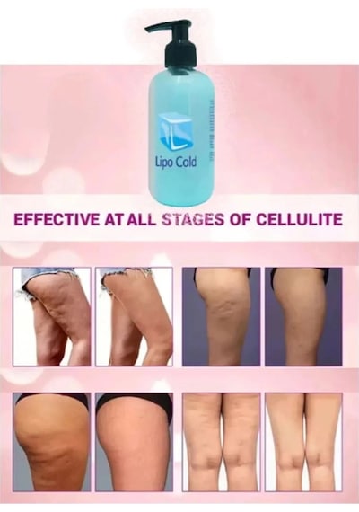Süper Lipo Cold G.çlü Krem 250 Ml X 2 Adet