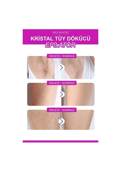 Kristal Tüy Dökücü Ağda Epilatör Crystal Eraser Epilasyon Aleti Tüy Silgisi Tüy Alıcı Fiziksel Pembe