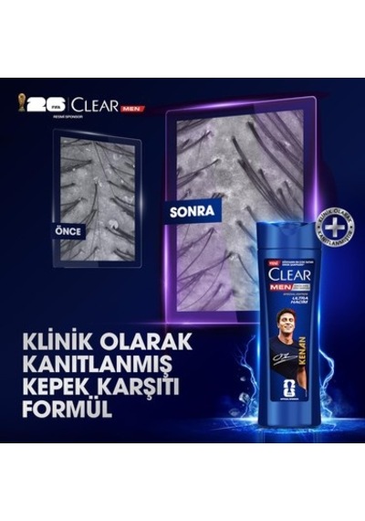 Ultra Hacim Sağlayan Kepeğe Karşı Şampuan 350 Ml
