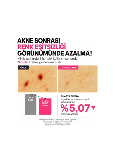 F.a.s.t. Pimple Eraser Roll-on - Kurutucu Akne Ve Sivilce Bakım Losyonu 15 Ml