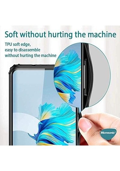 Xiaomi Mi 14 Ultra Kılıf Frosted Frame Siyah Mi 14 Ultra İle Uyumlu Kılıf - Siyah 50 x 22