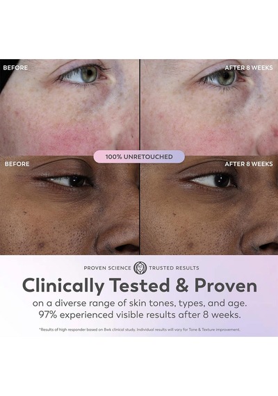Olay Mini Super Serum Aydınlatıcı Ve Yenileyici Yüz Serumu 14ml