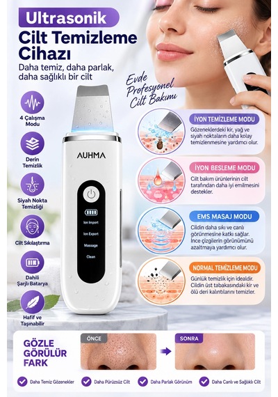 Auhma Ahb-13 Ultrasonik Cilt Temizleme Cihazı 4 Modlu Siyah Nokta Gözenek Temizleyici İyonlu Yüz Pee
