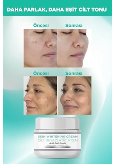 Tr Cilt Beyazlatıcı Krem, Leke Ve Renk Tonu Eşitsizliği Karşıtı, Alpha Arbutin Ve Vitamin C 100 Ml