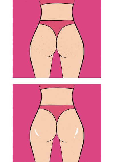 Skin Sensual Buttoks Strawberry Cheeks Vücut Maskesi | Çilek ve Tavuk Derisi Görünümüne Elveda | 2 Parça