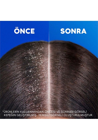 Head & Shoulders Limon Ferahlığı 2in1 Şampuan 330 ML