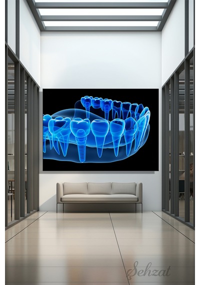 Yatay Kanvas Duvar Tablosu Ağız Diş Sağlığı Dişçi İmplant Röntgen 3d Çok Renkli
