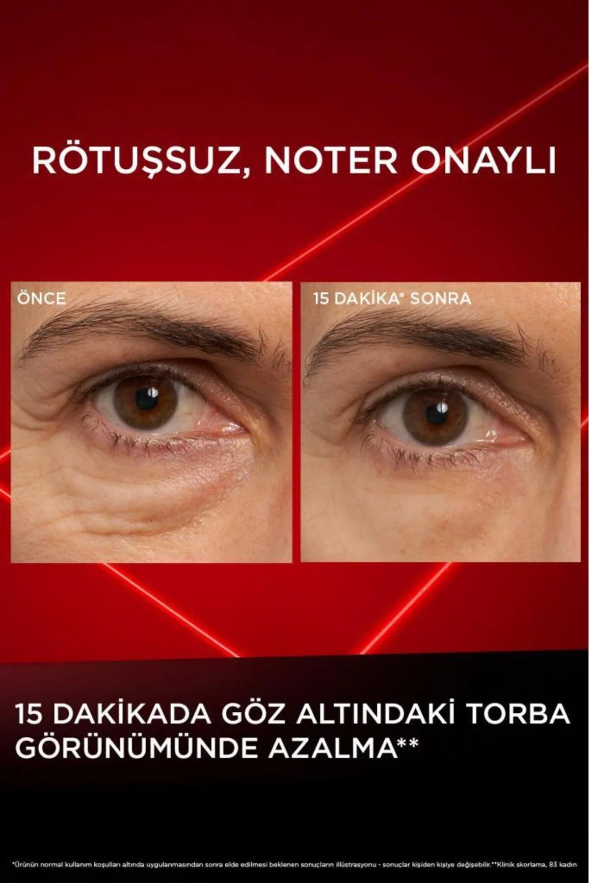 L'Oréal Paris Revitalift Lazer Eyebag Instant Eraser Göz Altı Torba Görünümüne Karşı Etkili Göz Kremi 15 ML