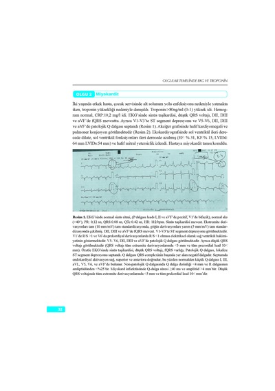 Olgular Temelinde Ekg Ve Troponin