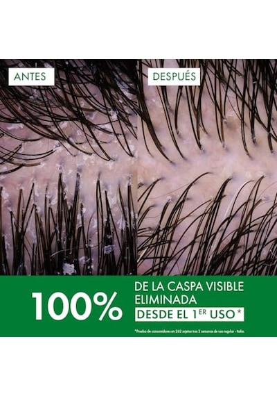 Dercos Anti Dandruff Normal Ve Yağlı Saçlar İçin Kepek Karşıtı Bakım Şampuanı 390 Ml Diğer