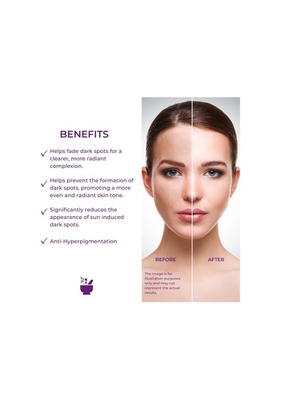 Cosmed Traneksamik Asit Ve Alpha Arbutin İçeren Leke Karşıtı Bakım Kremi 30 Ml