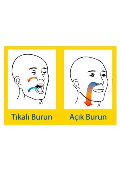 Medikalcim Horlama Önleyici Rahat Nefes Burun Aparatı-büyük 2 Adet