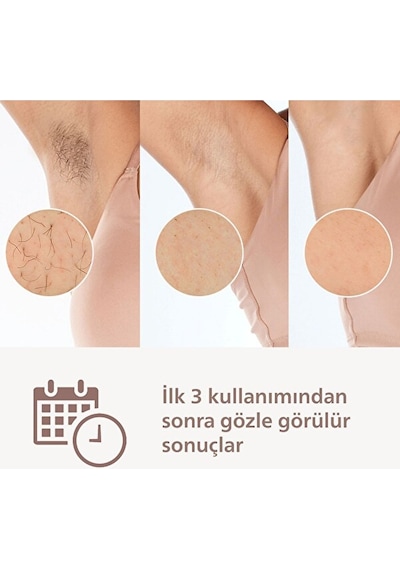 Philips Lumea Prestige Ipl Tüy Alma Cihazı + Vücut Ve Yüz Başlığı Brı950/00
