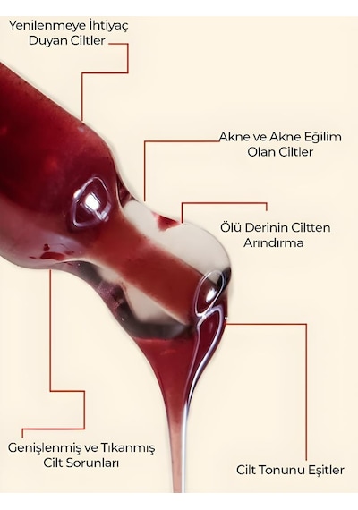 Ronna Beauty Akneli Ciltler İçin Red Peeling Serum 30 ML