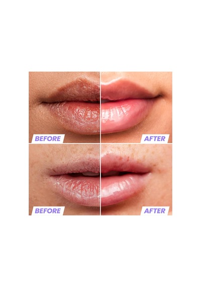 Wonderskin Lip Rehab Nemlendirici Ve Onarıcı Şeffaf Dudak Serumu Yağı Clear 3.57ml