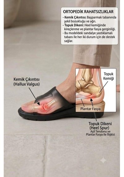 Kadın Siyah Cırtlı Anatomik Taban Topuk Dikeni Ve Kemik Çıkıntısı Günlük Terlik Ev Terliği Kadın Siyah Cırtlı Anatomik Taban Topuk Dikeni Ve Kemik Çıkıntısı Günlük Terlik Ev Terliği