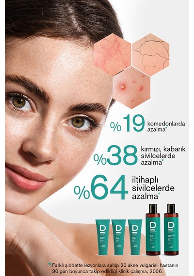 Akne Ve Karşıtı Onarıcı Yüz Leke Gece Kremi 30ml