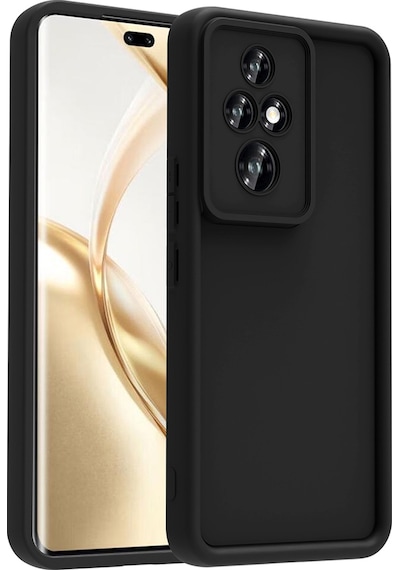 Zore Honor 200 Pro Kılıf Kamera Korumalı Ananas Kapak - Koyu Yeşil Koyu Yeşil