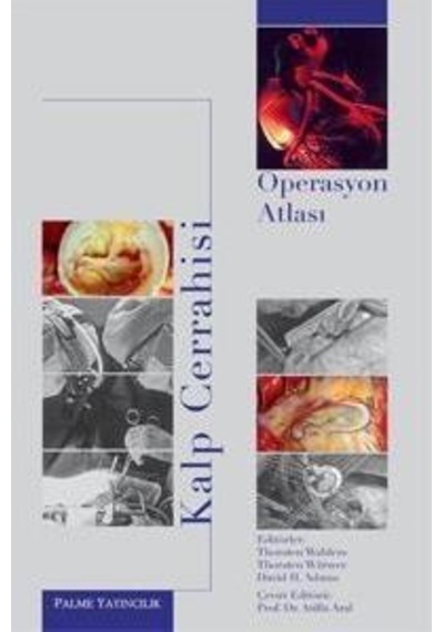 Kalp Cerrahisi Operasyon Atlası