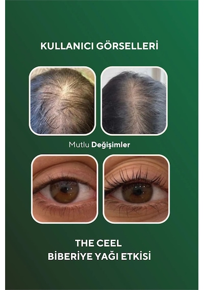 The Ceel 2'li Biberiye Yağı Sac Dökülmesi ve Aşırı Yıpranmış Saçlar için Biotin Özlü Saç Bakımı 50 ml