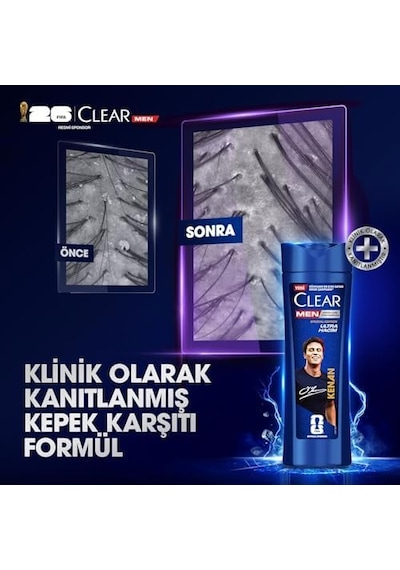 Men Kepeğe Karşı Etkili Şampuan Kenan Yıldız 350 Ml