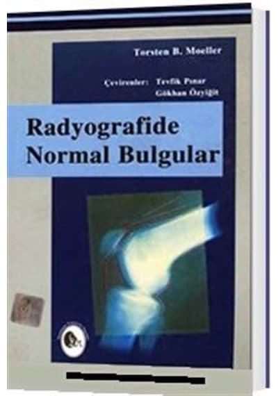 Radyografide Normal Bulgular / Kolektif