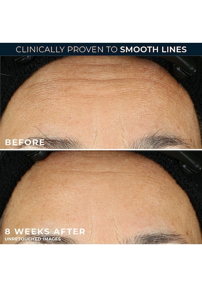 Retinol Correxion Line Smoothing Kırışıklık Karşıtı Kapsül Serum - 30 Adet