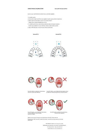Somnofit-b, Mandibular Alt Çene İlerletme Aparatı