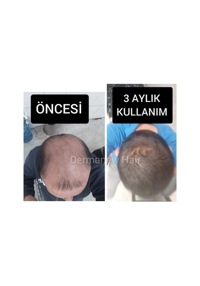Saç Büyüme Serumu, Hair, 50 Ml, 10'lü Set - Hair