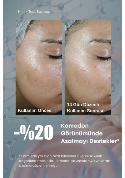 Retinol-ısh Serum