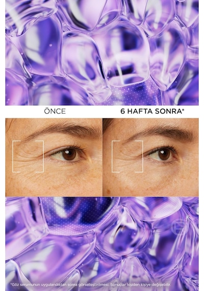 Revitalift Filler Aydınlatıcı Göz Serumu 20 Ml